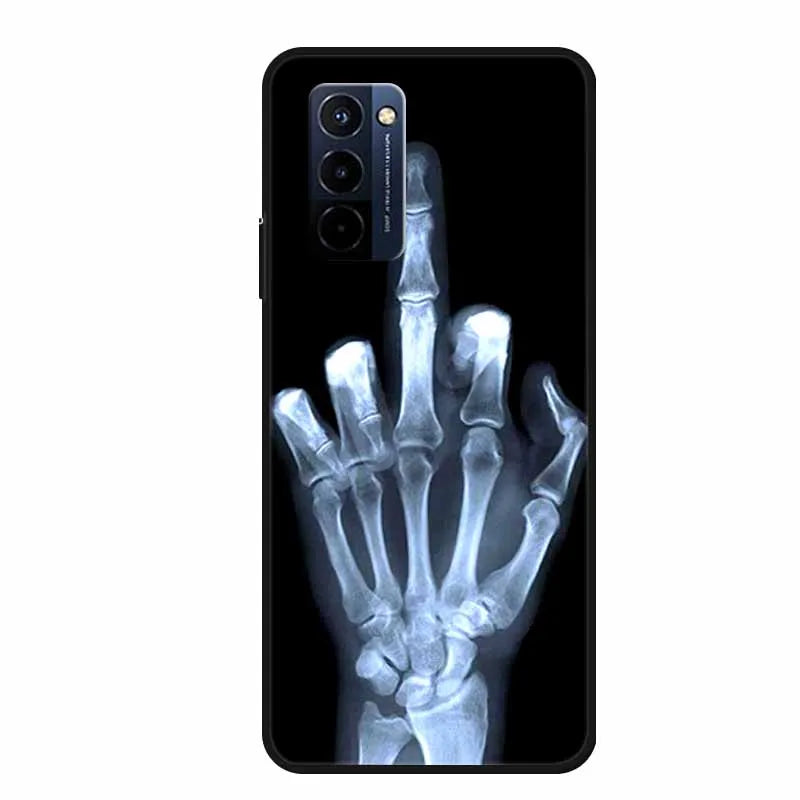 Funda para Wiko 10 – carcasa de silicona TPU suave pintada, antigolpes y protectora 360° (6.75”)